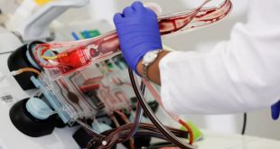 Rritet kërkesa për plazmë gjaku nga të shëruarit me virusin korona si terapi mbështetëse për pacientët e infektuar