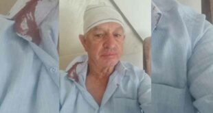 Veterani i UÇK-së pas protestës: “Që do të na kthehen Policia kundër neve, kurrë s’na ka shku ndërmend”