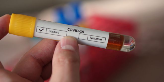 Në 24 orët e fundit konfirmohen 578 raste të reja me Covid-19, ndërsa shërohen 470 pacientë të tjerë