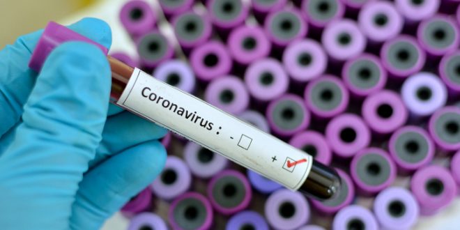 Numri i rasteve aktive me virusin korona aktualisht në Kosovë është 1.393 persona të infektuar