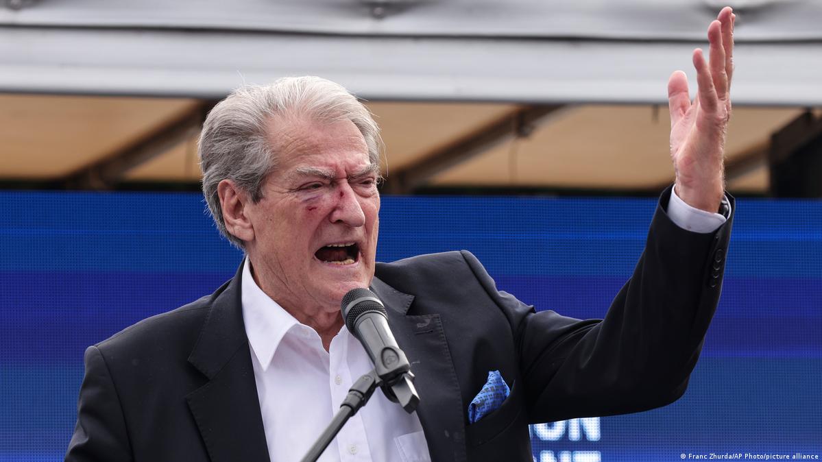 Mehmet Bislimi  Sali Berisha  ky zjarrvënës i Shqipërisë 